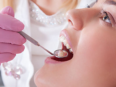 Brockport Smiles | Fluoride Treatment, Dental Fillings and Dentures